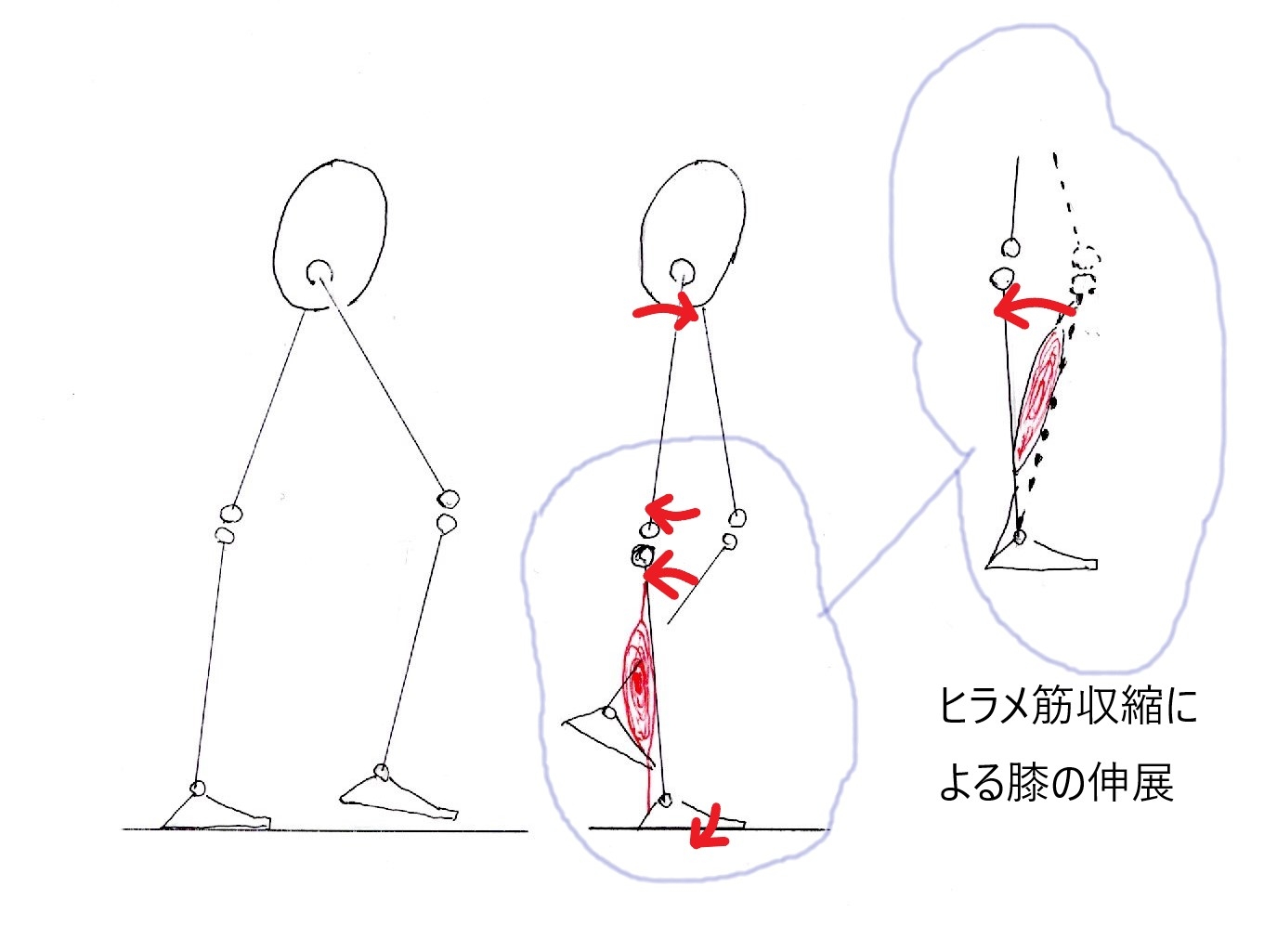 ヒラメ筋膝の伸展