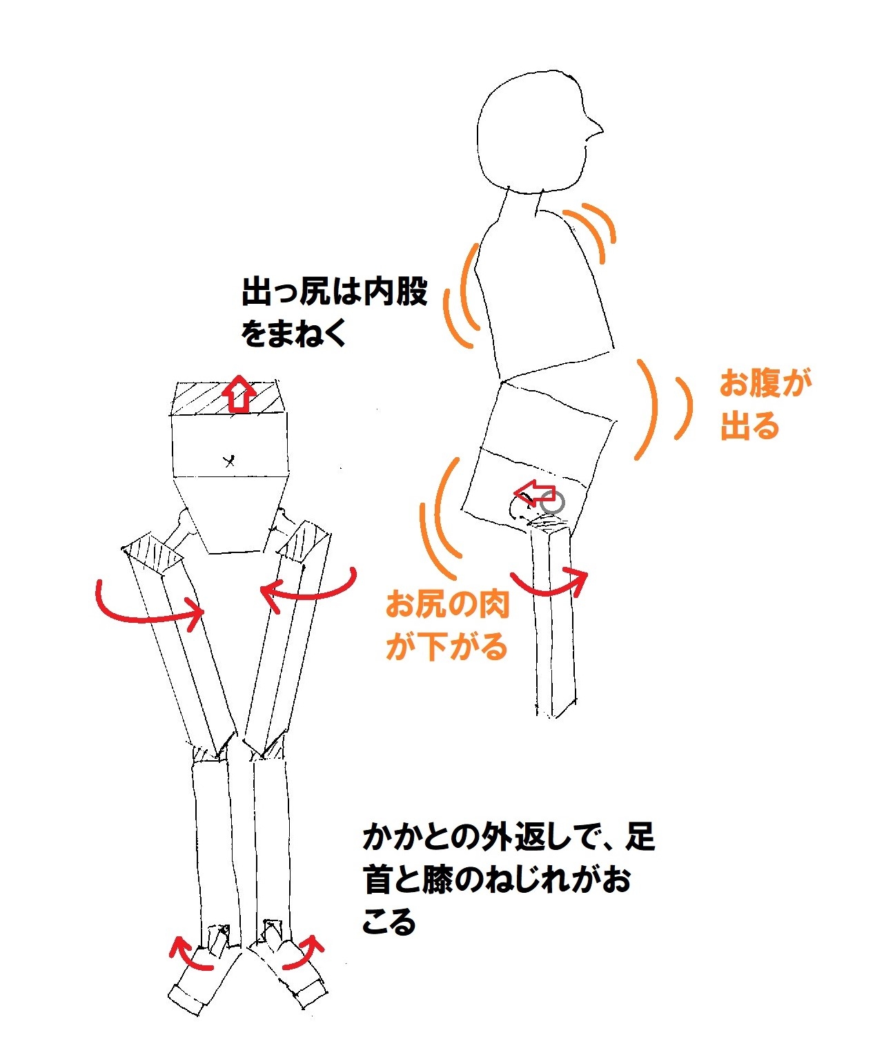 体型の崩れ