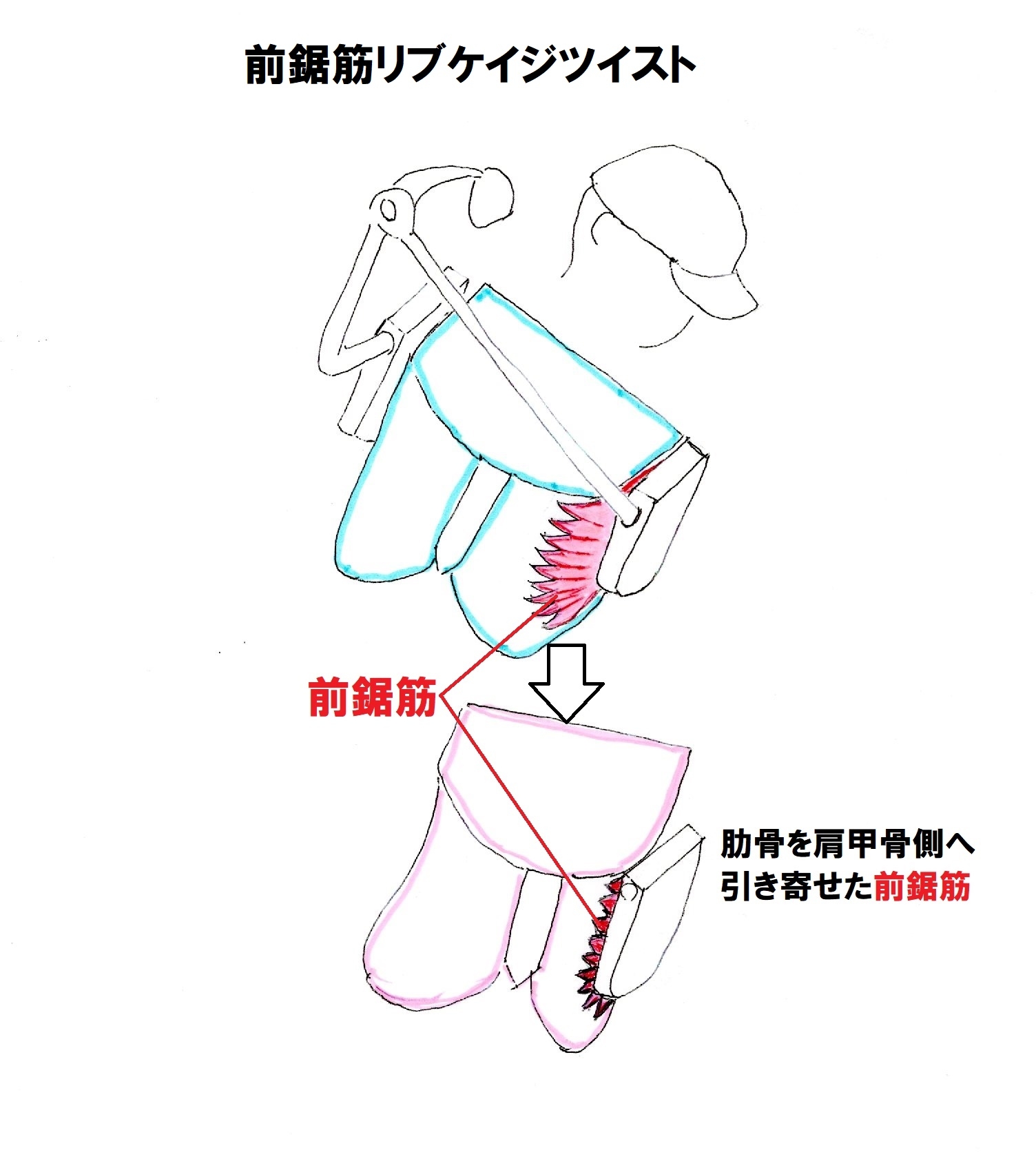 正面から見た前鋸筋リブケイジツイスト