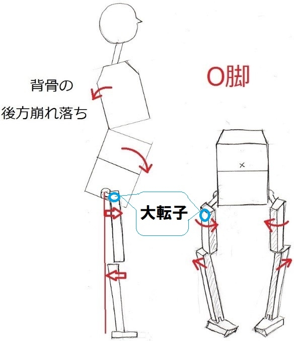 O脚メカニズム