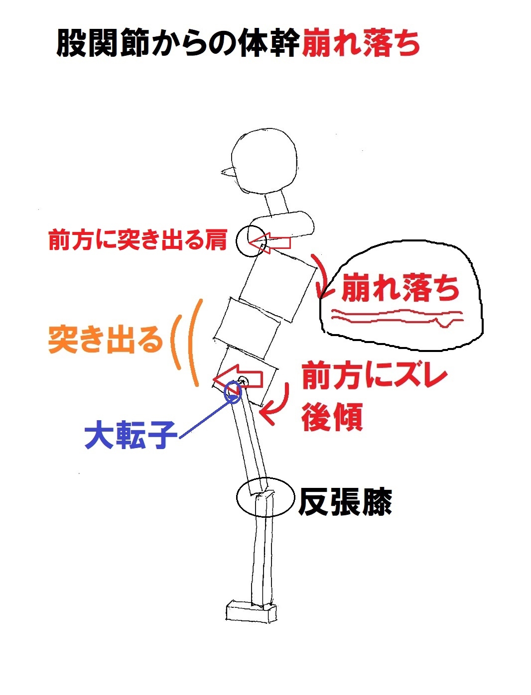 片脚立ち姿勢と歩行が姿勢矯正の鍵をにぎる